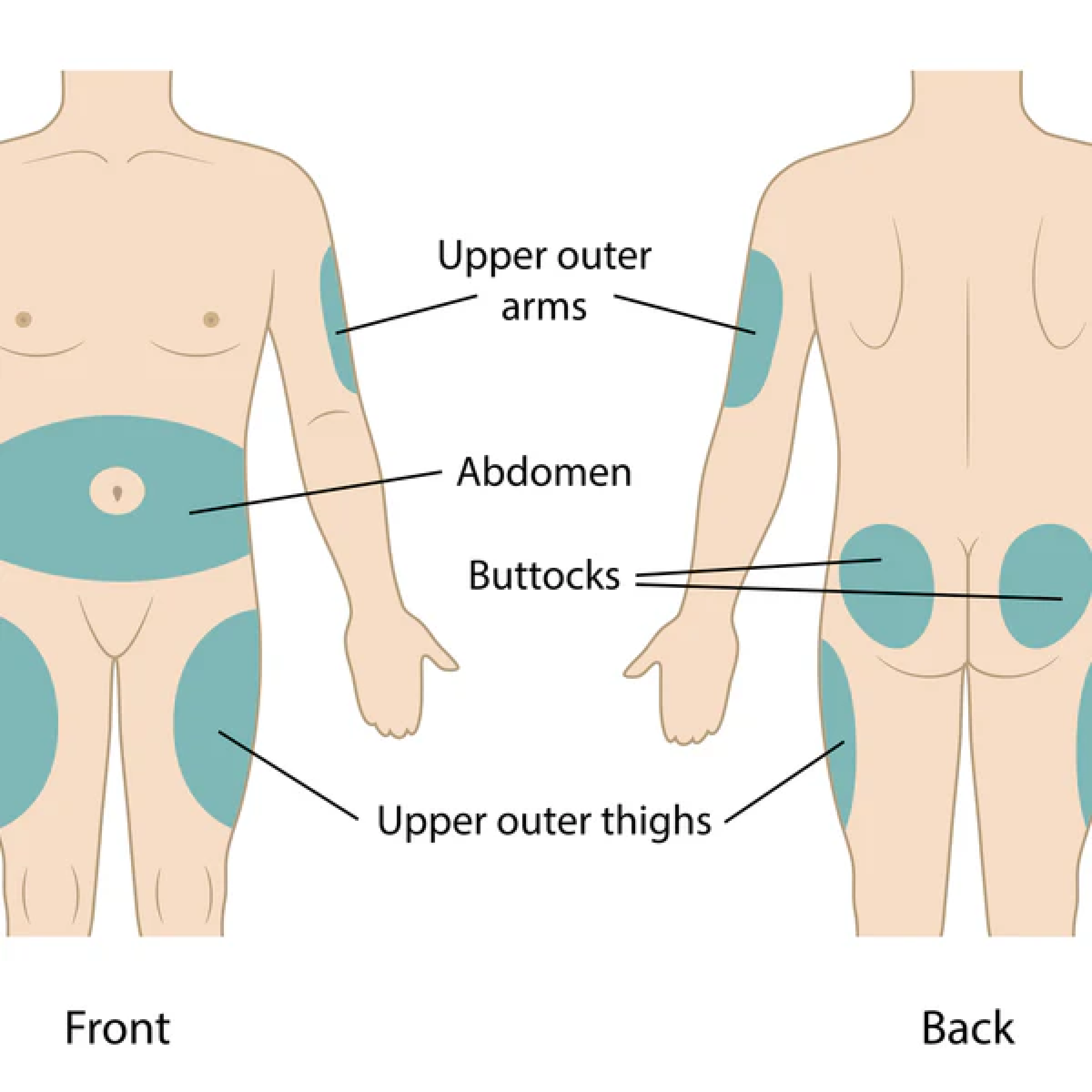 Tirzepatide Units